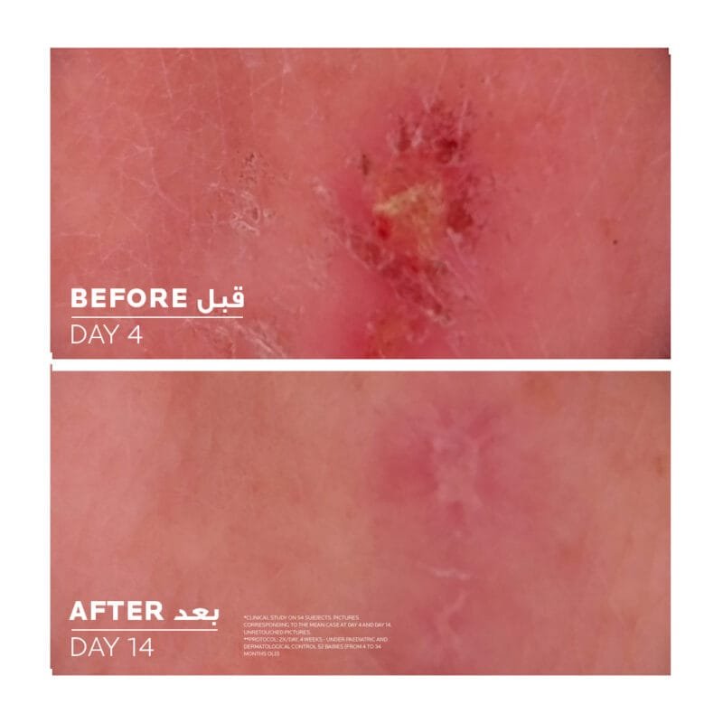 ⁦لاروش بوزيه سيكابلاست بوم بي 5+ كريم ملطف ومعالج⁩ - الصورة ⁦4⁩
